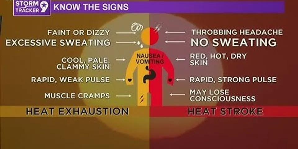 A sign of heat stroke is skin that is red, hot, and dry, with no sweating.