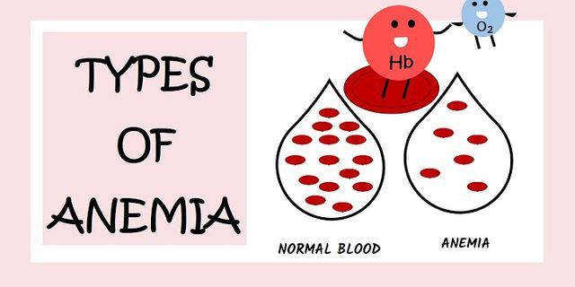 anemia là gì - Nghĩa của từ anemia