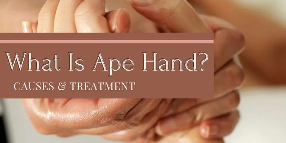 ape hands là gì - Nghĩa của từ ape hands
