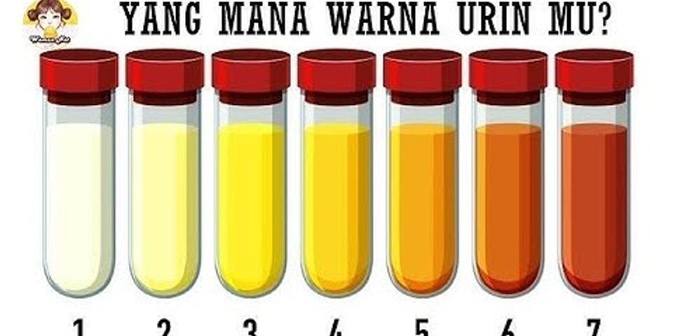 Berapa cc urin normal?