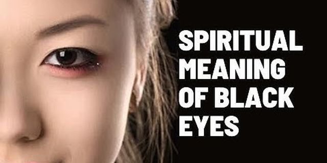 black eyes là gì - Nghĩa của từ black eyes