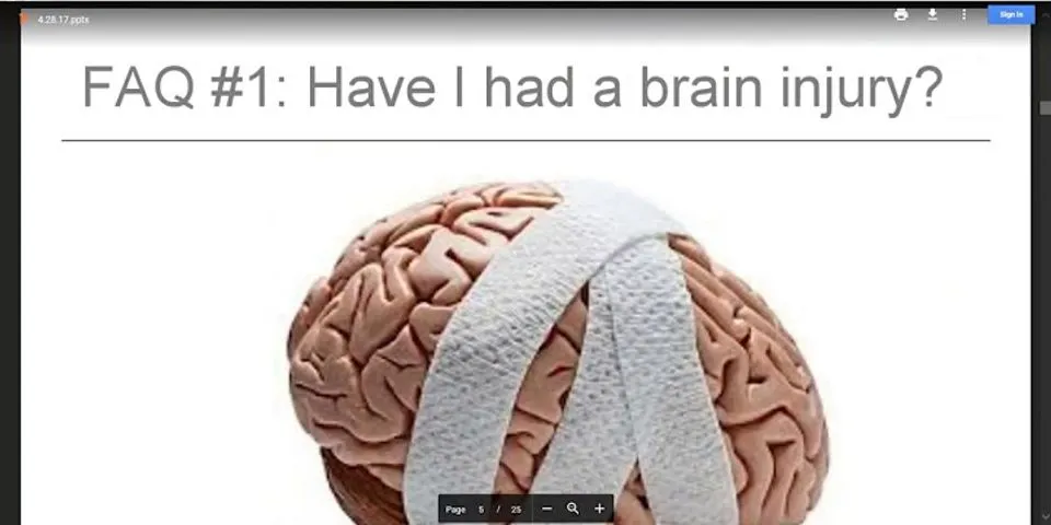brain injury là gì - Nghĩa của từ brain injury