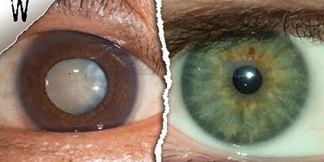 brown eye là gì - Nghĩa của từ brown eye