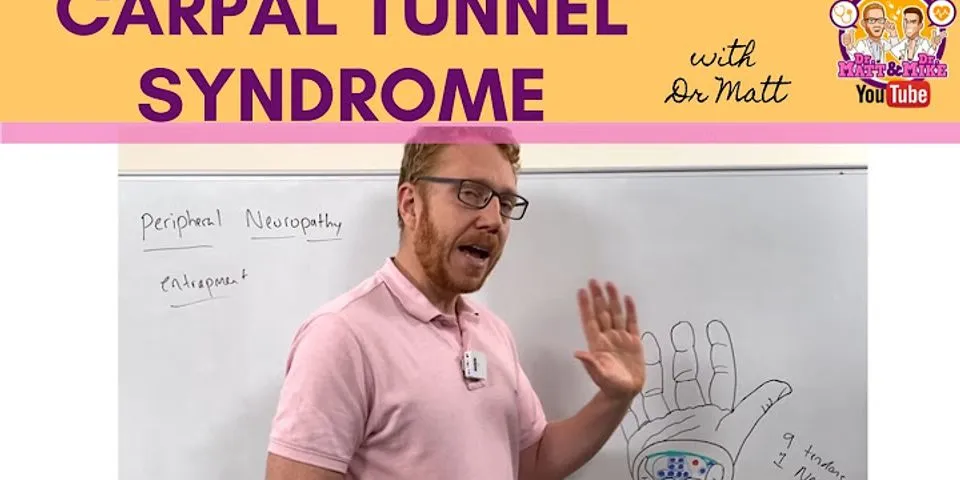 carpal tunnel syndrome là gì - Nghĩa của từ carpal tunnel syndrome