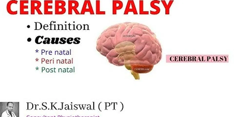 cerebral palsy là gì - Nghĩa của từ cerebral palsy