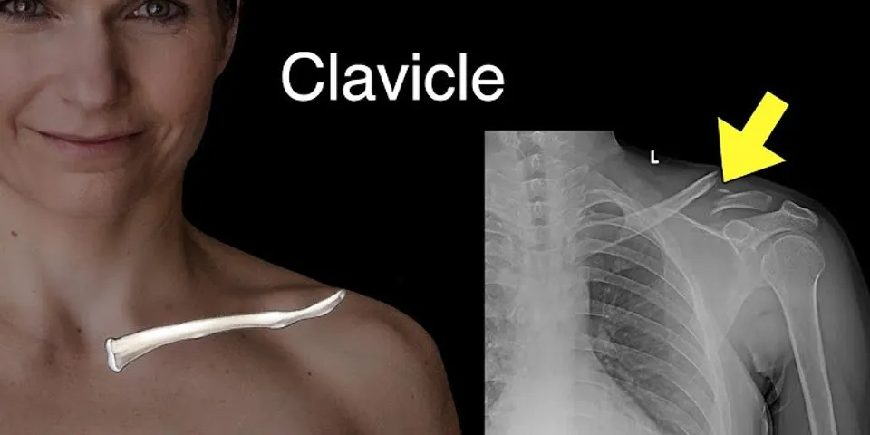 clavicle là gì - Nghĩa của từ clavicle