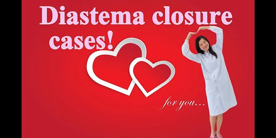 closure kiss là gì - Nghĩa của từ closure kiss