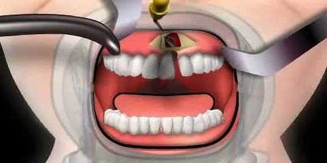 dental surgery là gì - Nghĩa của từ dental surgery