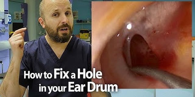ear hole là gì - Nghĩa của từ ear hole