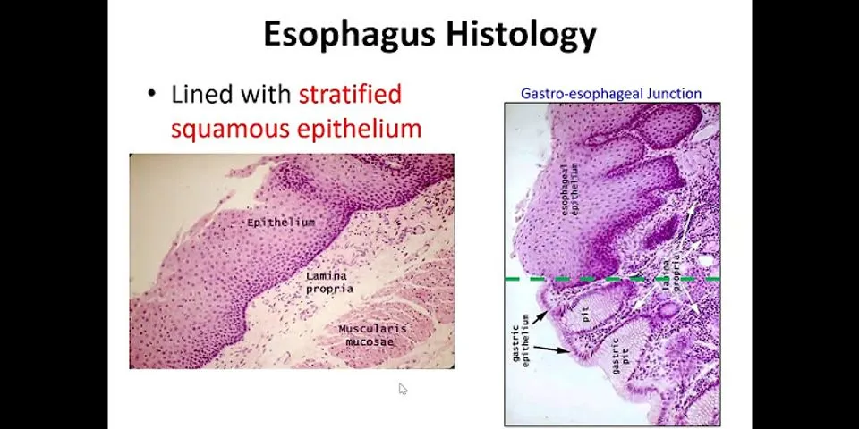 esophagus annihilater là gì - Nghĩa của từ esophagus annihilater