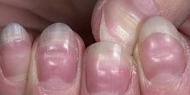 fingernails là gì - Nghĩa của từ fingernails