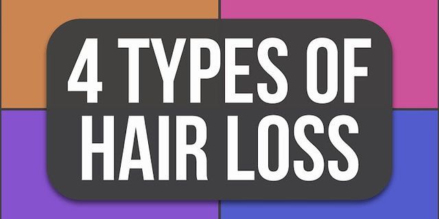 hair loss là gì - Nghĩa của từ hair loss