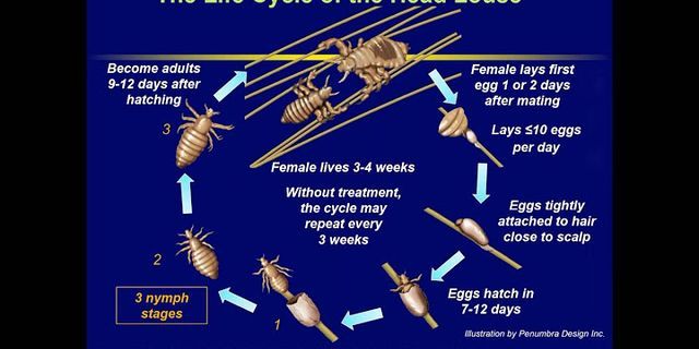 head lice là gì - Nghĩa của từ head lice
