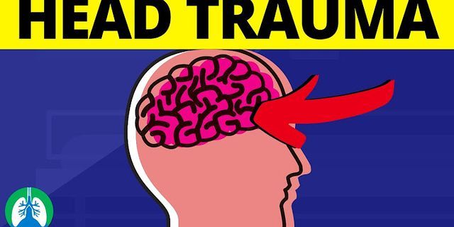head trauma là gì - Nghĩa của từ head trauma