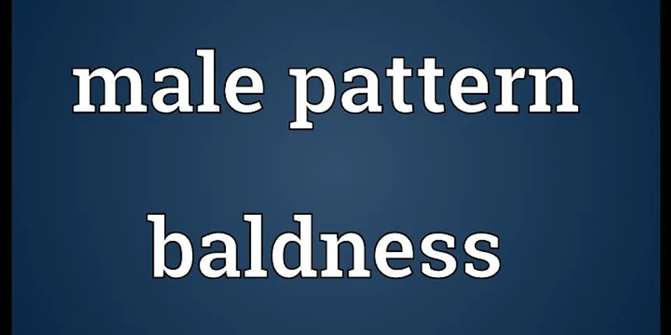 male pattern baldness là gì - Nghĩa của từ male pattern baldness