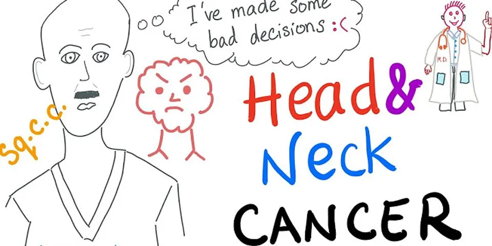 neck cancer là gì - Nghĩa của từ neck cancer