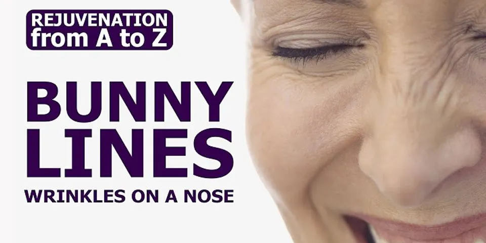 nose wrinkles là gì - Nghĩa của từ nose wrinkles