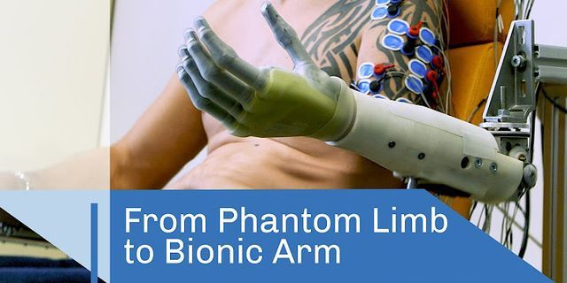 phantom limb là gì - Nghĩa của từ phantom limb