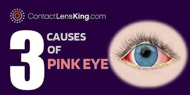 pink eye là gì - Nghĩa của từ pink eye