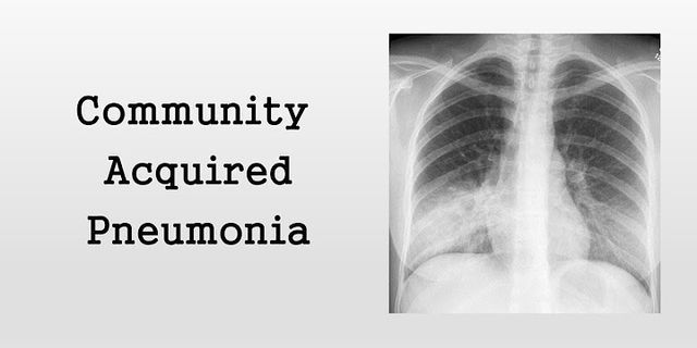 pto pneumonia là gì - Nghĩa của từ pto pneumonia