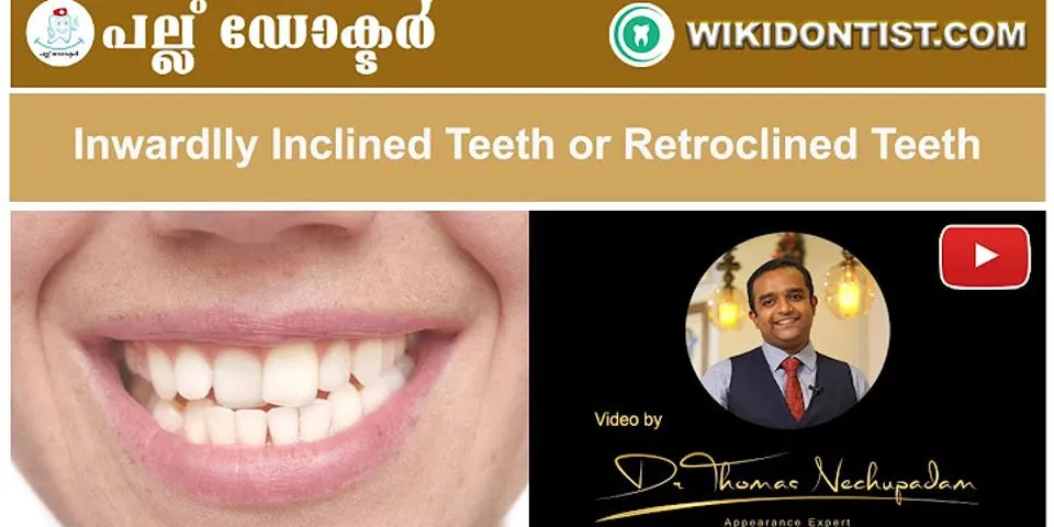 Retro inclined teeth