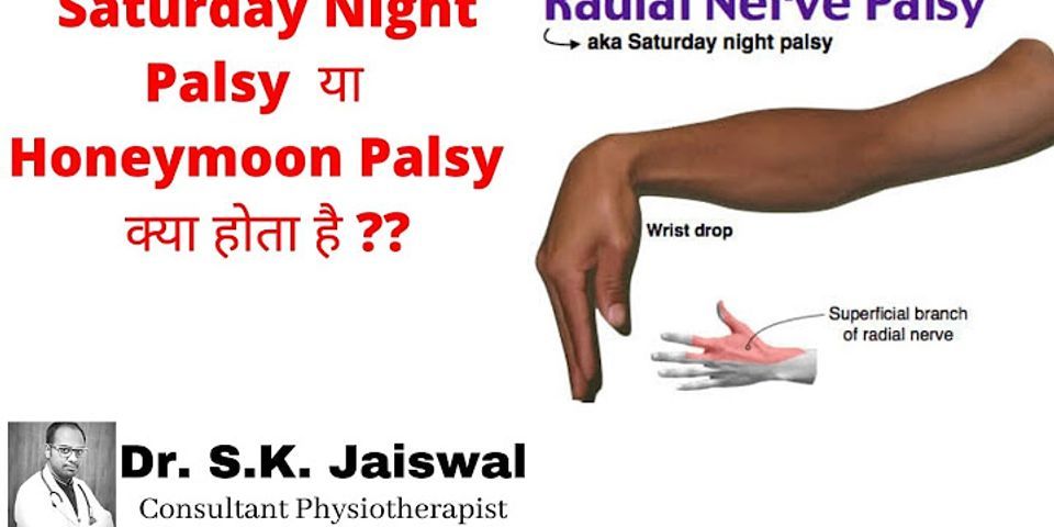 saturday night palsy là gì - Nghĩa của từ saturday night palsy