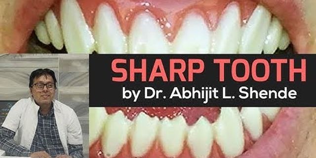 sharp teeth là gì - Nghĩa của từ sharp teeth