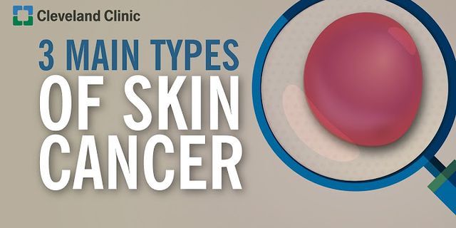 skin cancer là gì - Nghĩa của từ skin cancer