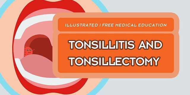 tonsil stones là gì - Nghĩa của từ tonsil stones