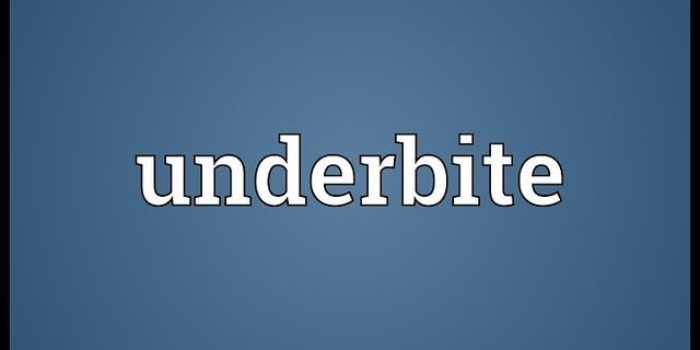 underbite là gì - Nghĩa của từ underbite