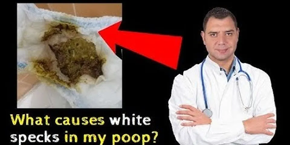 white poop là gì - Nghĩa của từ white poop